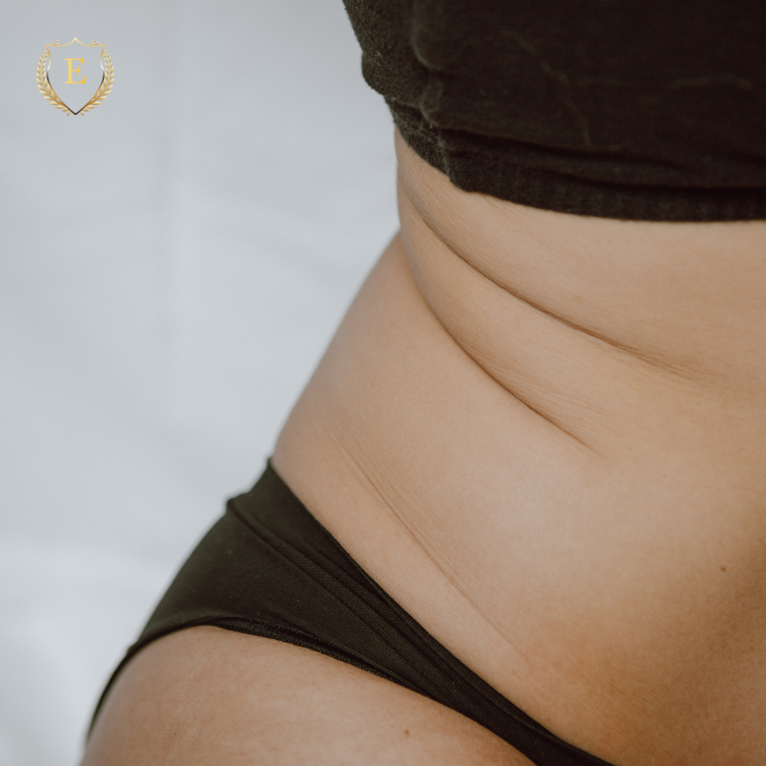 conseguir el cuerpo perfecto